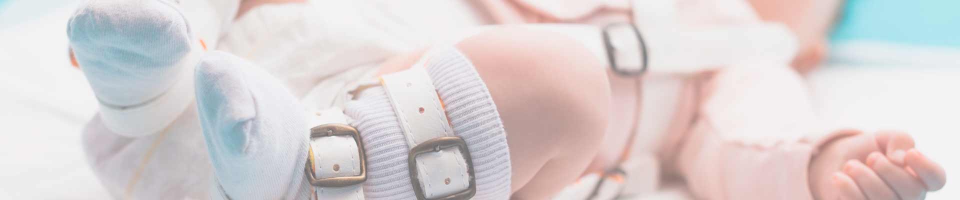 Hueftluxation-beim-Saeugling