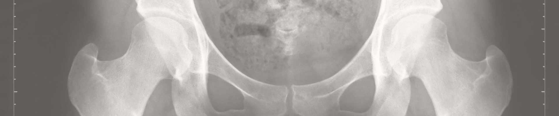 Roentgenkontrolle-einer-Dysplasie